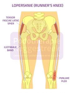 https://www.podotherapiereggestreek.nl/wp-content/uploads/2019/01/lopersknie-runners-knee-podotherapie-reggestreek-rijssen.png