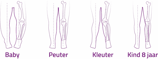 Ontwikkeling van kindervoeten Podotherapie Reggestreek Rijssen