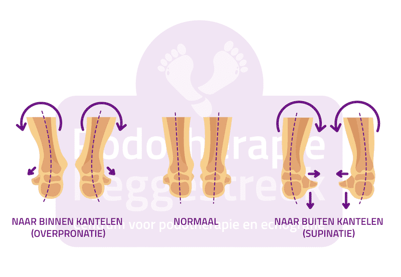 Stand Voet Normaal Valgisatie Varisatie Podotherapie Reggestreek Rijssen
